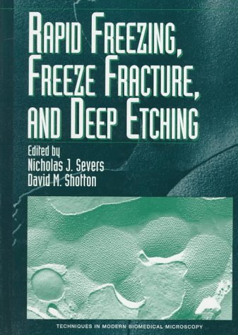 Book cover : Rapid Freezing, Freeze Fracture, and Deep Etching